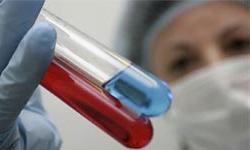 Охват тестирования на ВИЧ ежегодно увеличивается