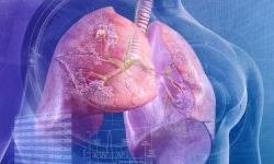 Робот помогает бороться с онкологией