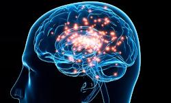 Возможности нейростимуляции