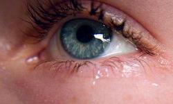 Синдром сухого глаза