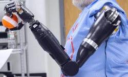 Изготовлен персонализированный нейропротез